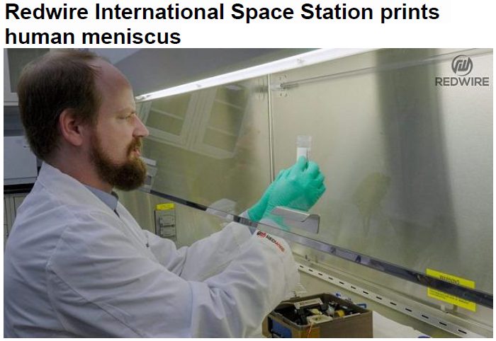 Read more about the article Redwire International Space Station prints human meniscus