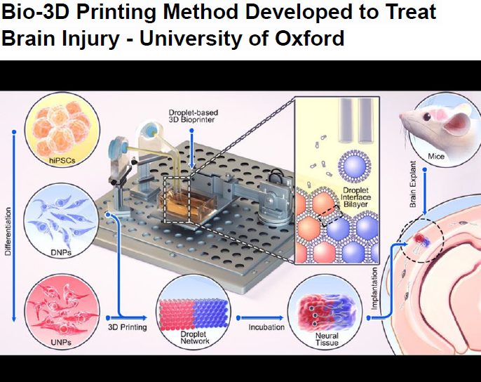 Read more about the article Bio-3D Printing Method Developed to Treat Brain Injury – University of Oxford