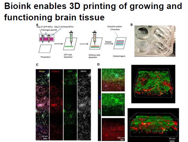 Read more about the article Bioink enables 3D printing of growing and functioning brain tissue